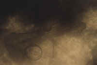 xray.jpg (48009 bytes)